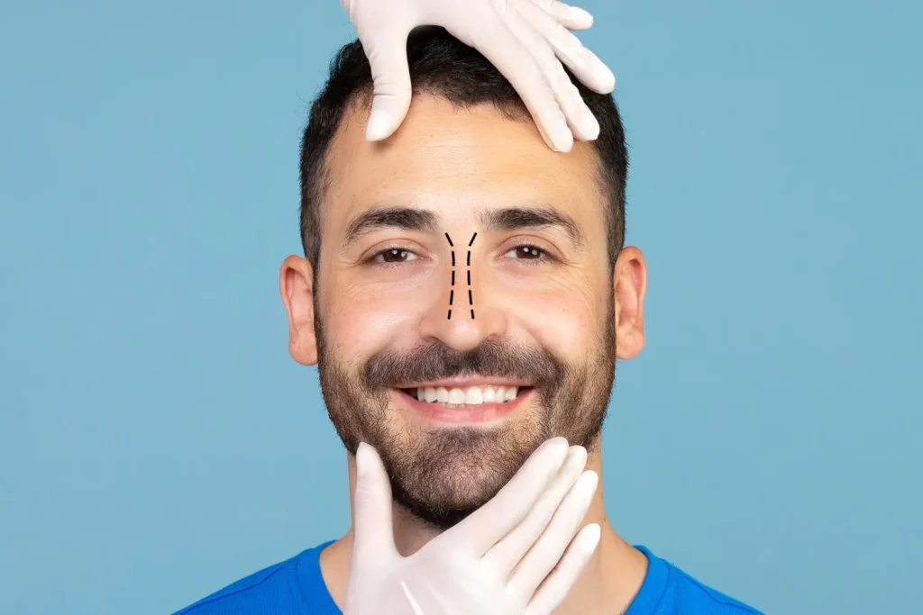 Perfilamiento facial masculino: equilibrio y naturalidad Perfilamiento facial masculino: equilibrio y naturalidad